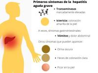 Preocupan casos de hepatitis  grave de niños en el mundo