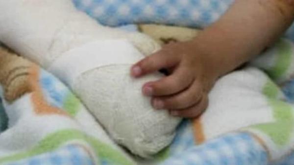 Niño pierde 4 dedos al querer “espantar granizo” con dinamita