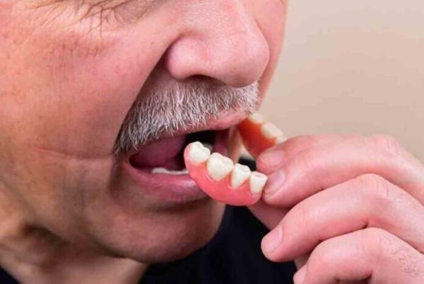 CONSEJOS PARA UNA ADAPTACIÓN RÁPIDA A TU NUEVA PRÓTESIS DENTAL